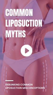 Ten common misconceptions about liposuction